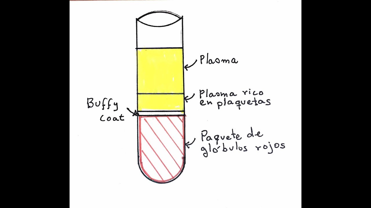 ¿Cómo ENGAÑAN con el Plasma rico en Plaquetas?