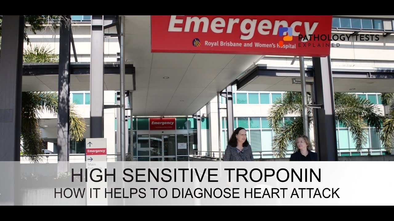Troponin - the emergency department blood test and what it can show if you've had a heart attack