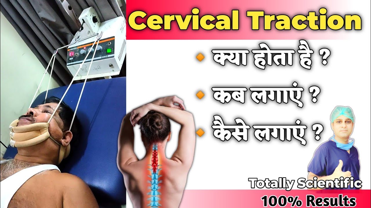 गर्दन दर्द, सर्वाइकल स्पोंडिलाइटिस, स्लिप डिस्क कैसे ठीक करें | What is Cervical Traction | Hindi