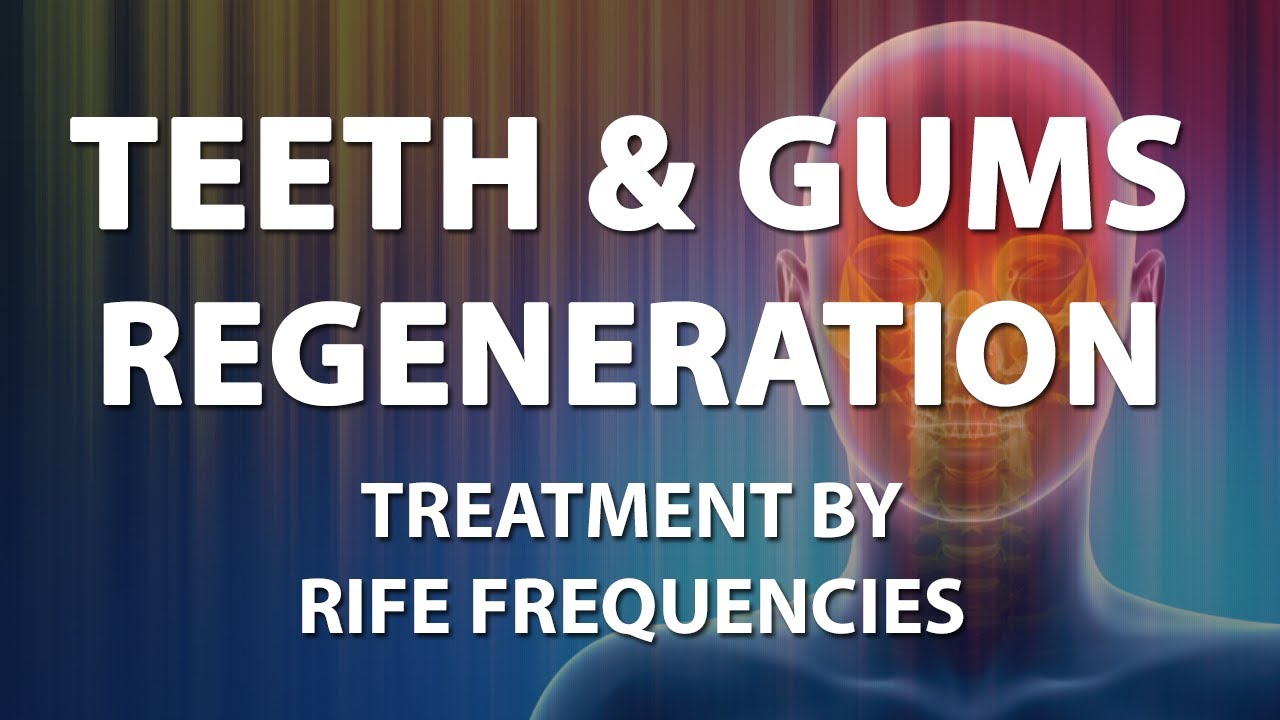 Teeth and Gums Regeneration (Tooth) - RIFE Frequencies Treatment - Energy & Quantum Medicine