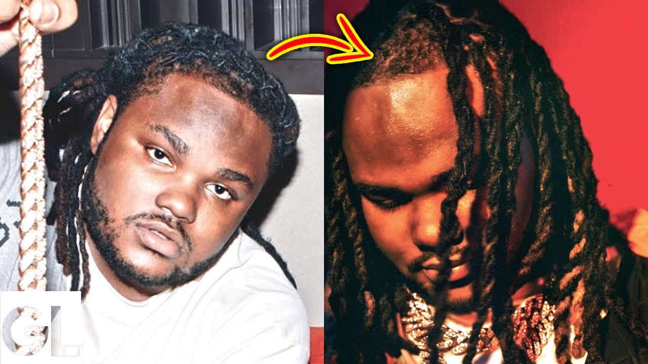Why Tee Grizzley’s Dreadlocks Are Falling Out