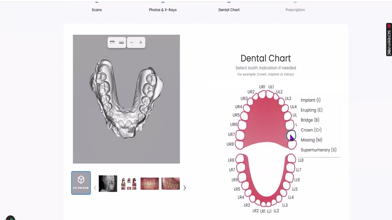 uDesign Cloud - Submit a case to uAssist