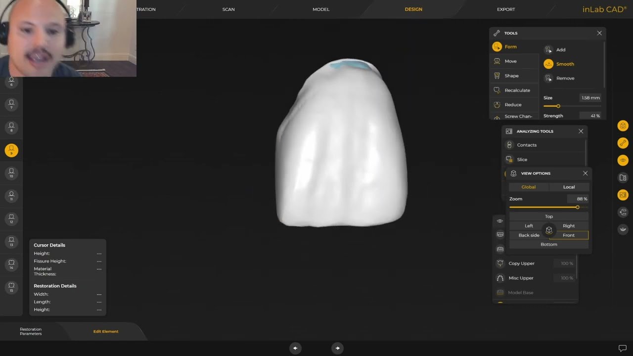 How To Get Better Bio Copy Proposals  with CEREC