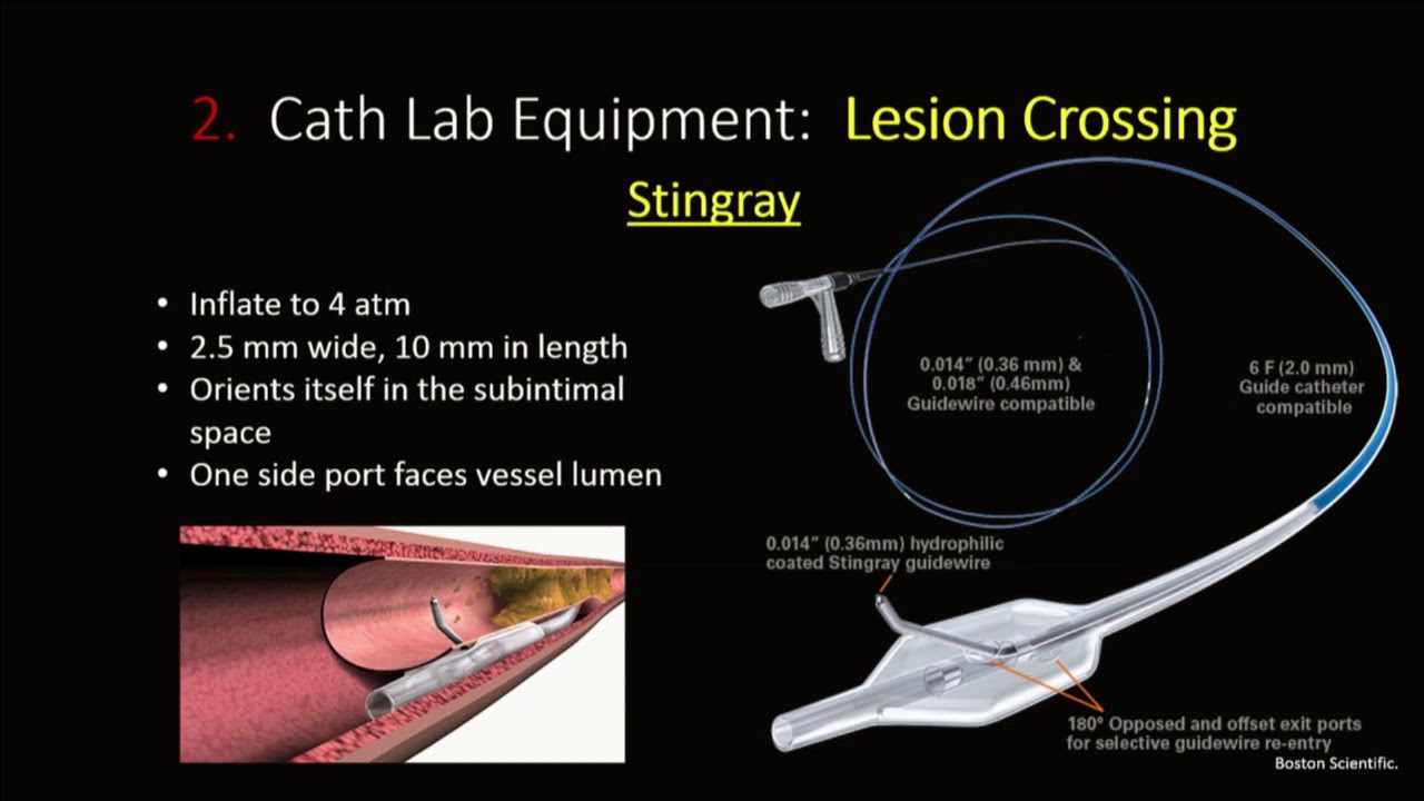 CTO PCI: Tools of the Trade - Michael Luna, MD