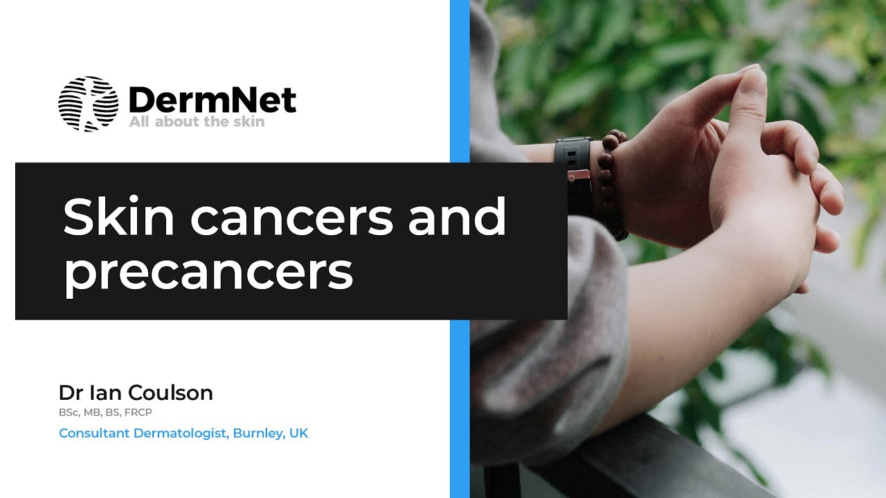Skin cancers and precancers: essentials