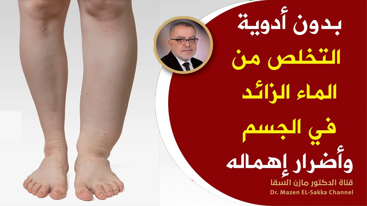 لهذه الأسباب يحتبس الماء في الجسم طرق التخلص من الماء  الزائد وعلاج احتباس الماء في الجسم بالاعشاب