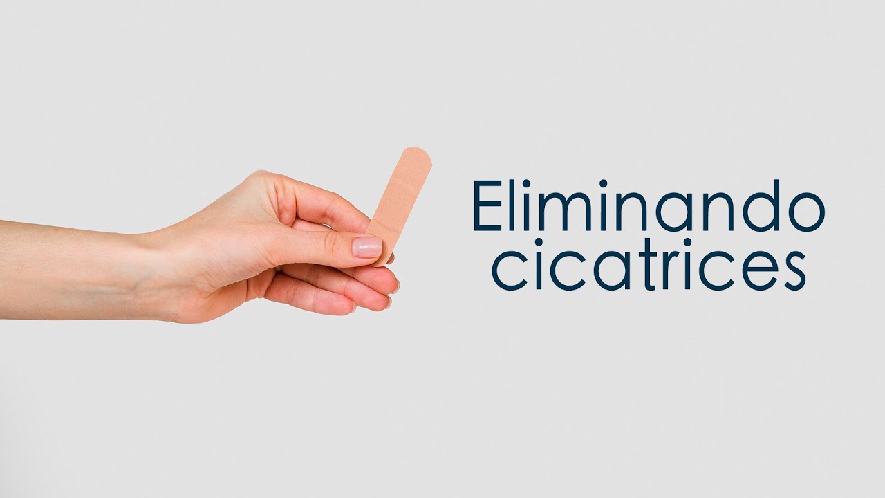 Escrito Está - Eliminando las cicatrices