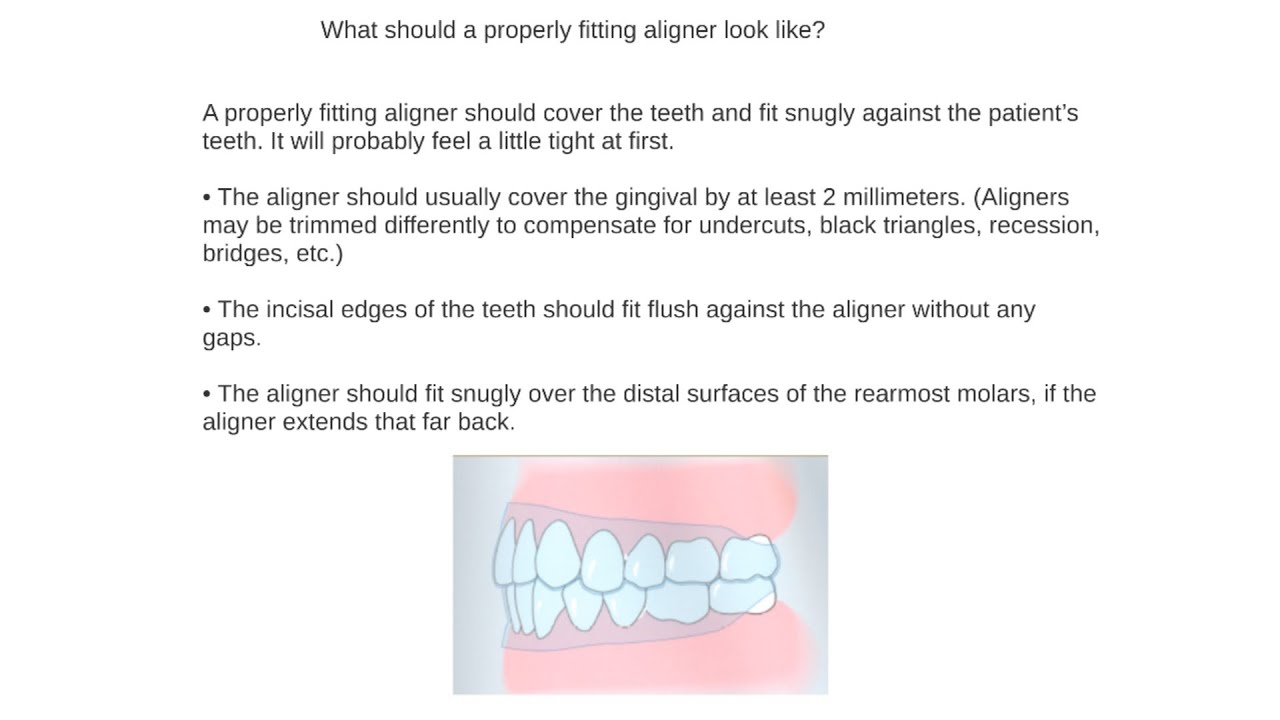 What to do if aligner fits loose. How to close a posterior open bite. My lecture from 2020 - Part 8.