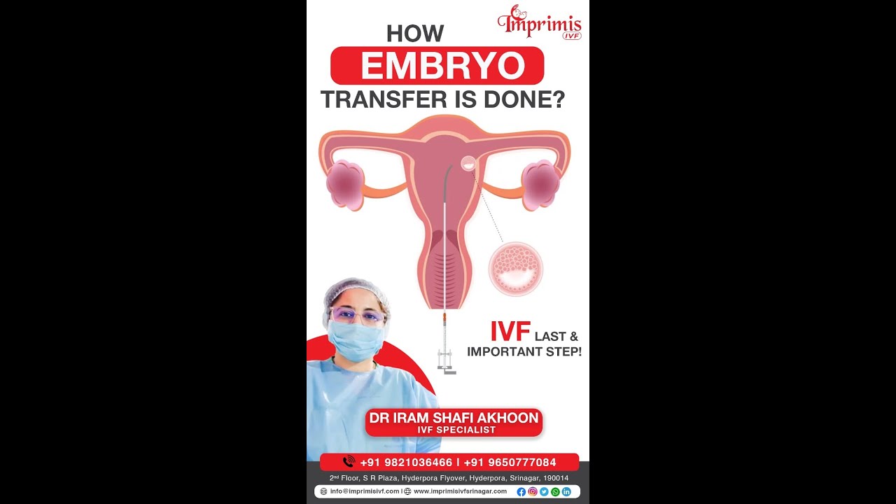 Embryo Transfer Process by Dr Iram | IVF Treatment in Srinagar - Imprimis IVF & Fertility Centre