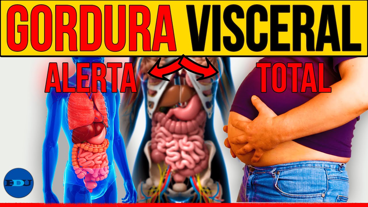 DIABETES TIPO 2: FALSO MAGRO E GORDURA VISCERAL │ @EDUDiabetes