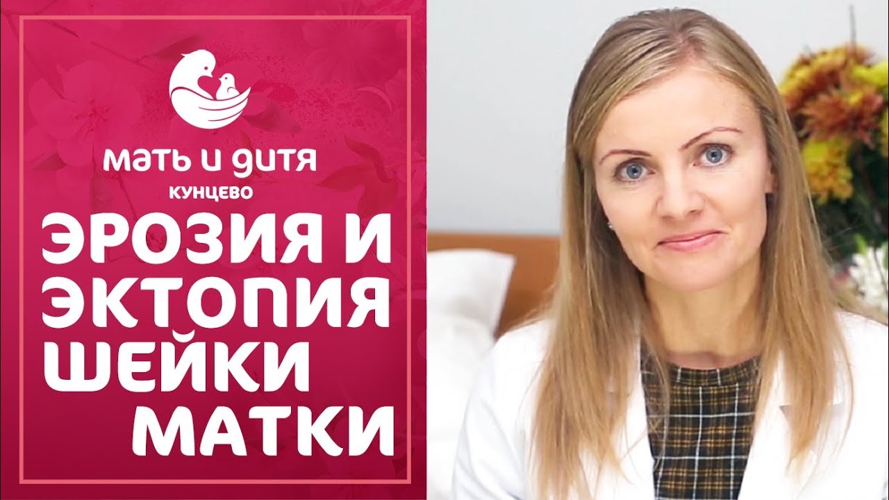 👩  Что такое эрозия и эктопия шейки матки, причины и лечение. Эрозия и эктопия шейки матки. 12+