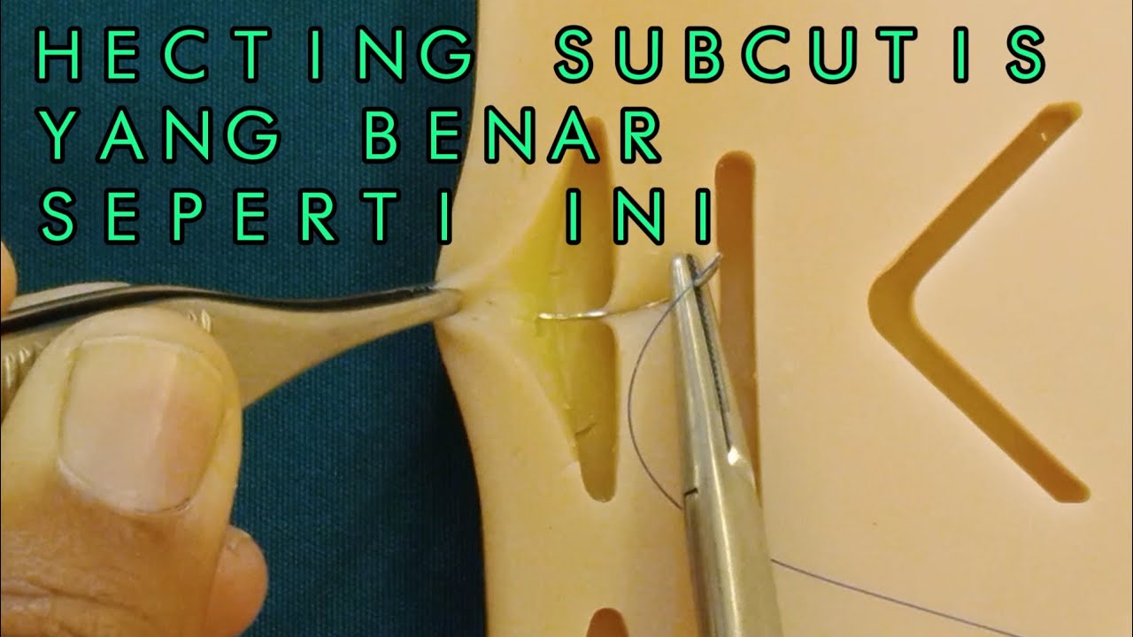 CARA TEKNIK HECTING SUBCUTIS -MENJAHIT SUBCUTIS