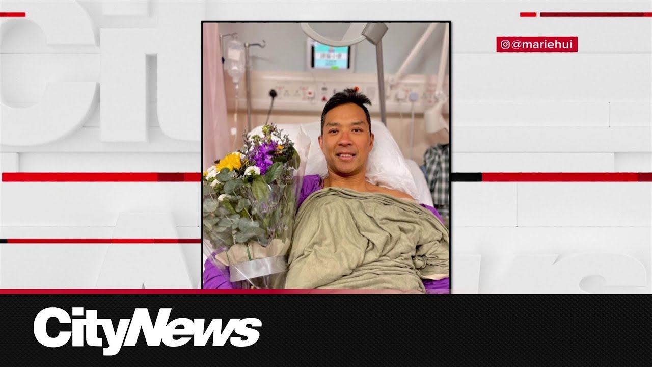 Vancouver firefighter details road to recovery after losing leg to flesh-eating bacteria