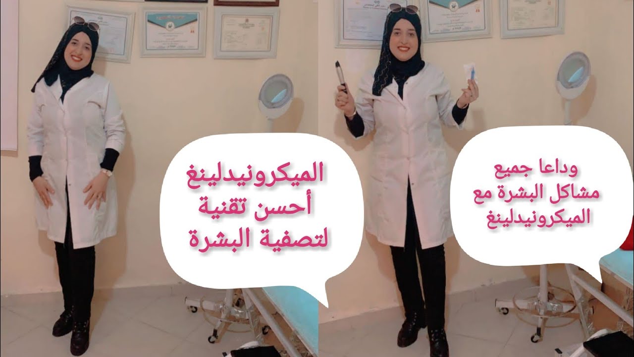 شرح تقنية الميكرونيدلينغ بأدق التفاصيل و كيفاش نستعملوها من أجل تصفية بشرتنا💯