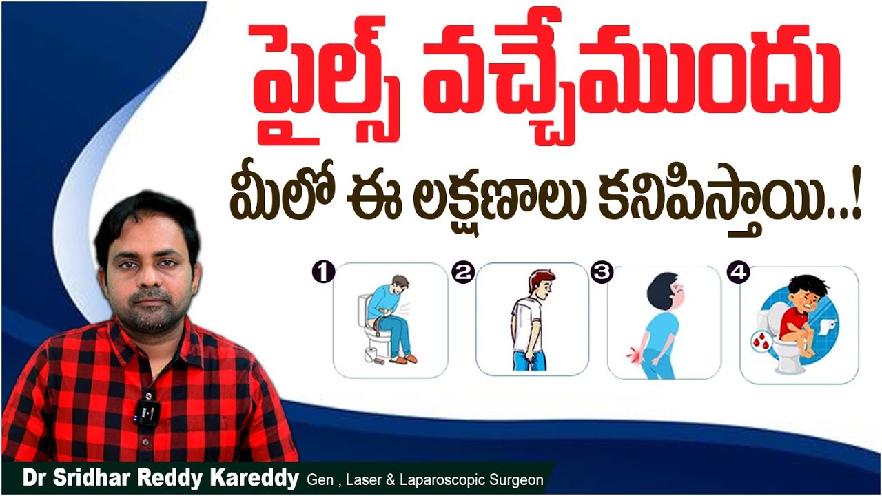 పైల్స్ లక్షణాలు || How to Detect Piles? || Piles Symptoms and Treatment in Telugu || Treatment Range