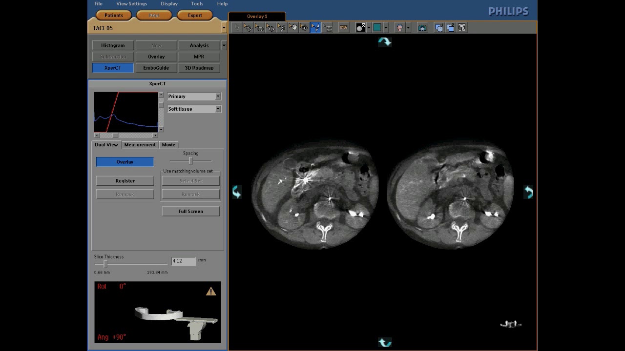 EMBO GUIDE Dashboard 1 - Xper CT Dual with Dual View.