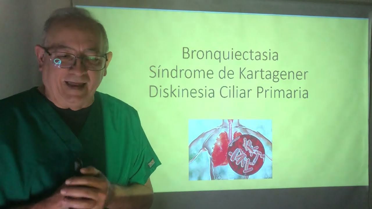Síndrome de Kartagener. Ectasia bronquial . Dískinesia Ciliar Primaria. Hemoptisis