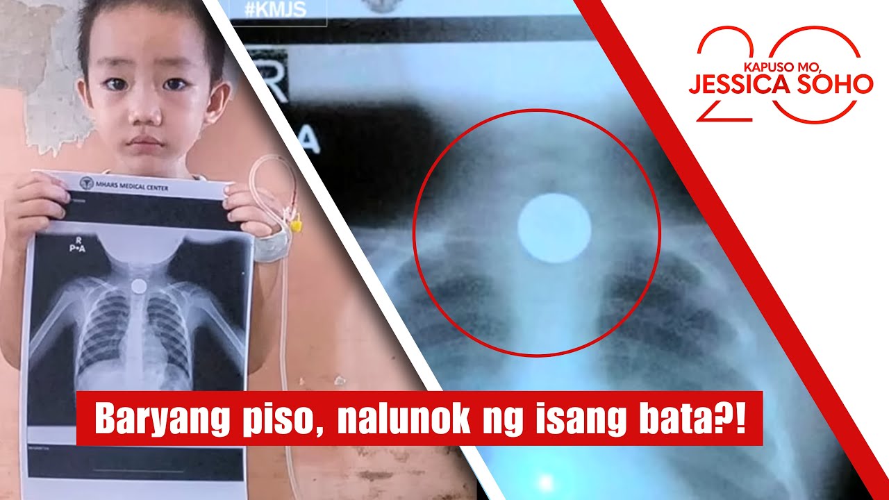 Baryang piso, nalunok ng isang bata?! | Kapuso Mo, Jessica Soho