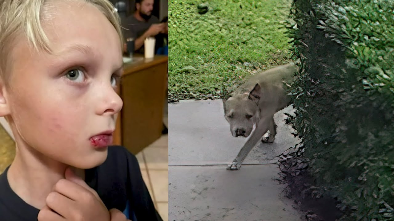 Stray Pit Bull attacked an 8-year-old boy