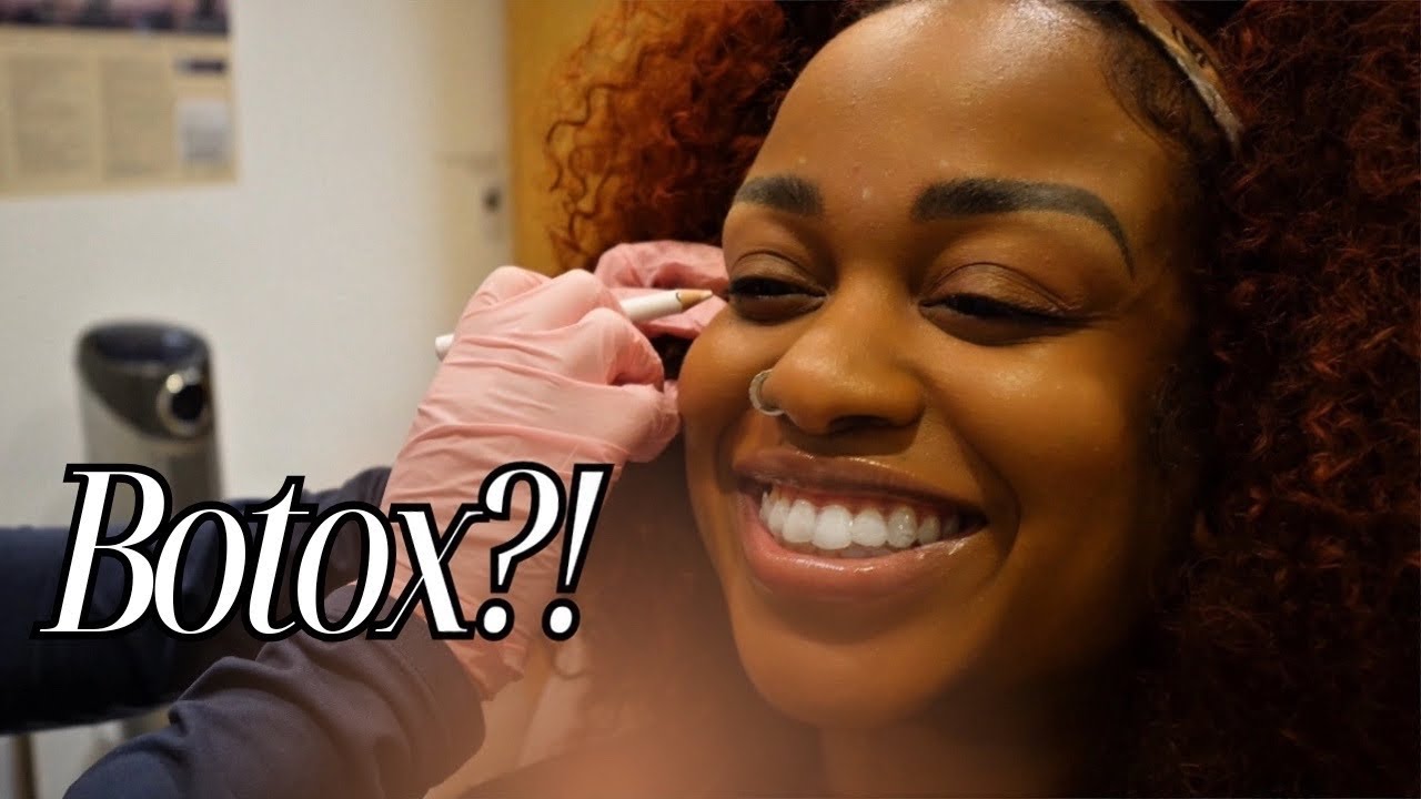 Black Women Get Botox Too! My Botox Experience