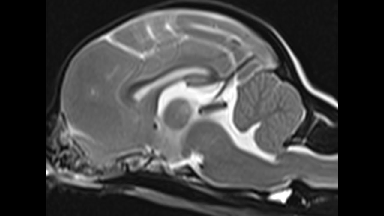 What to Know About Chiari-Like Malformation & Syringomyelia