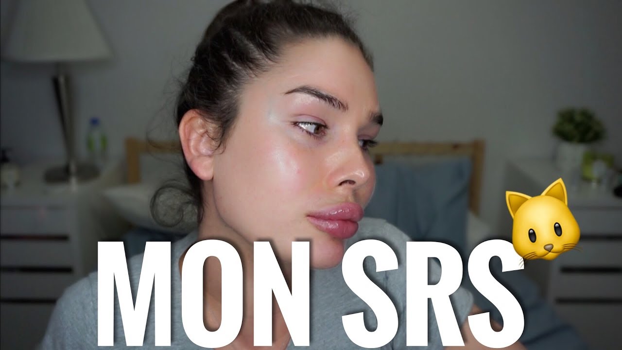 MA GROSSE OPÉRATION (SRS PARTIE 1) | GABRIELLE MARION
