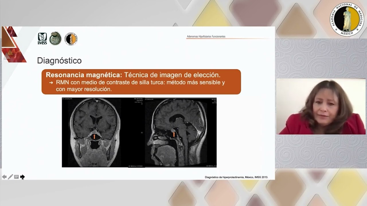 5. Tumores productores de prolactina. Dra. María de Lourdes Basurto Acevedo