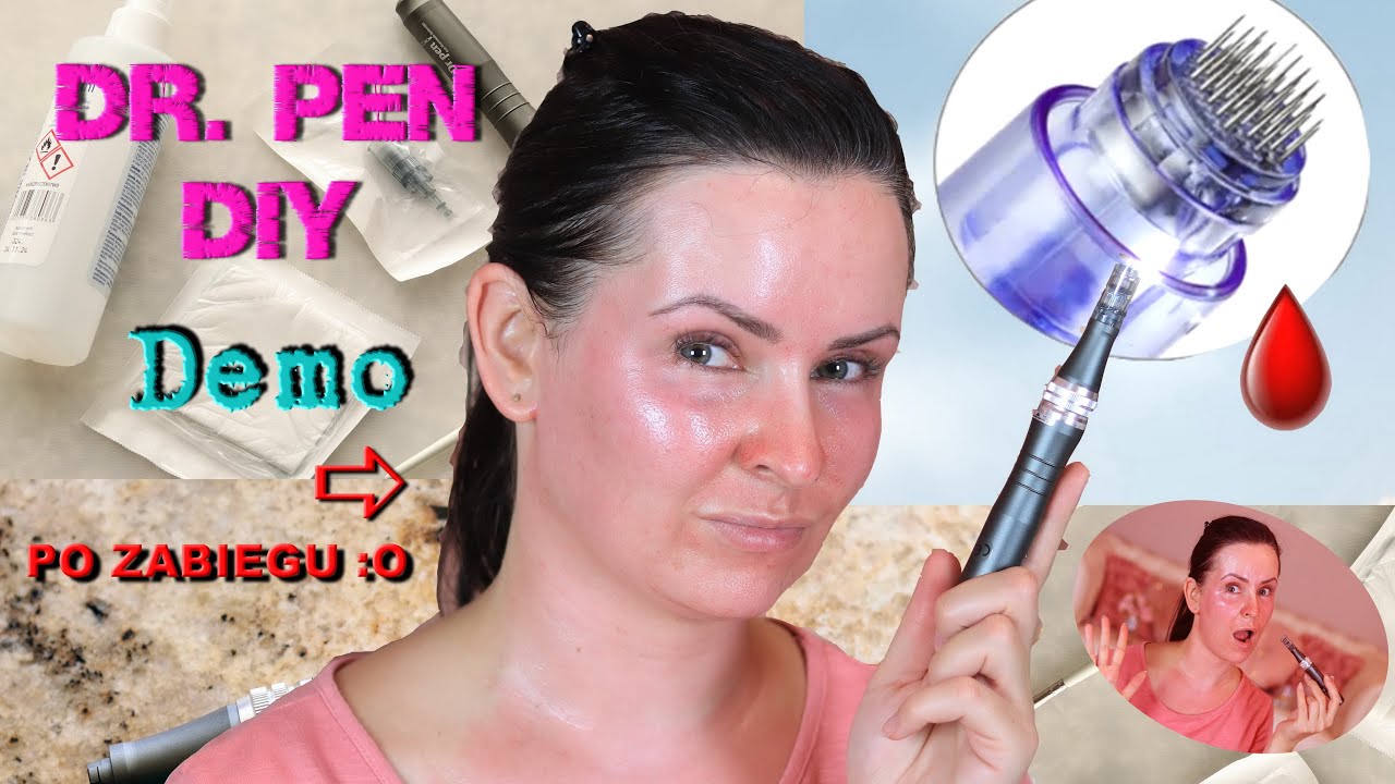 MEZOTERAPIA MIKROIGŁOWA DIY - Full Demo, Mnóstwo Cennych Info!