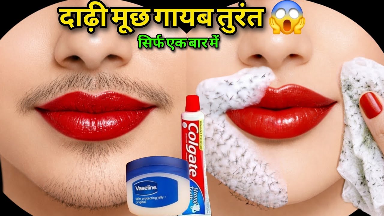 डॉक्टर ने बताया Vaseline से बिना दर्द चेहरे के बाल निकालने का आसान तरीका😱|| Facial Hair Removal