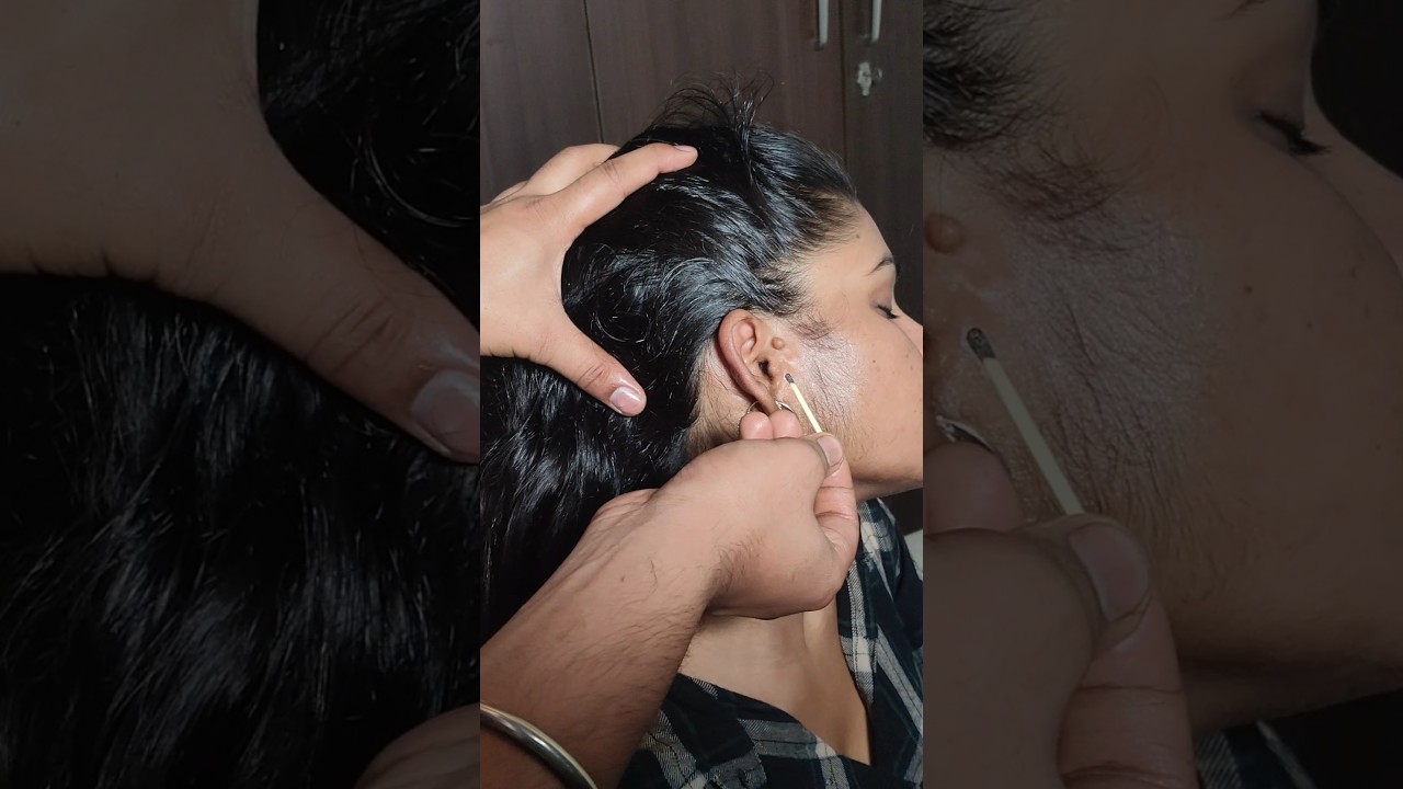 ASMR ear Cleaning and Deep🔴 Oiling#asmr#earwaxremoval#satisfying#earwax#earwaxtreatment#reels#shorts
