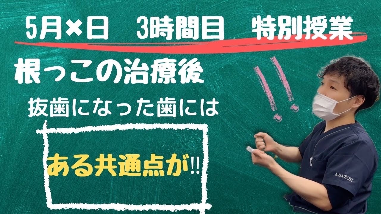 ＜重要＞根管治療後、抜歯になってしまった歯の共通点とは？？！#歯医者