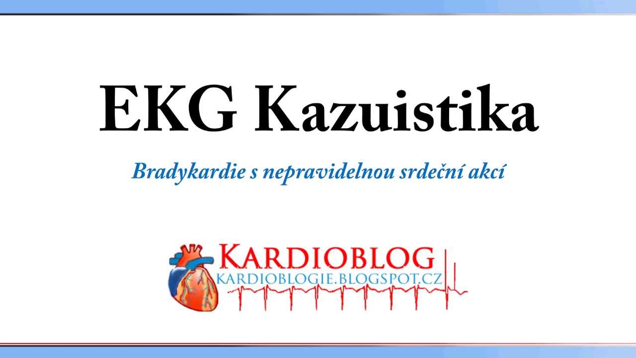 Kardioblog - EKG Kazuistika Bradykardie s nepravidelnou srdeční akcí
