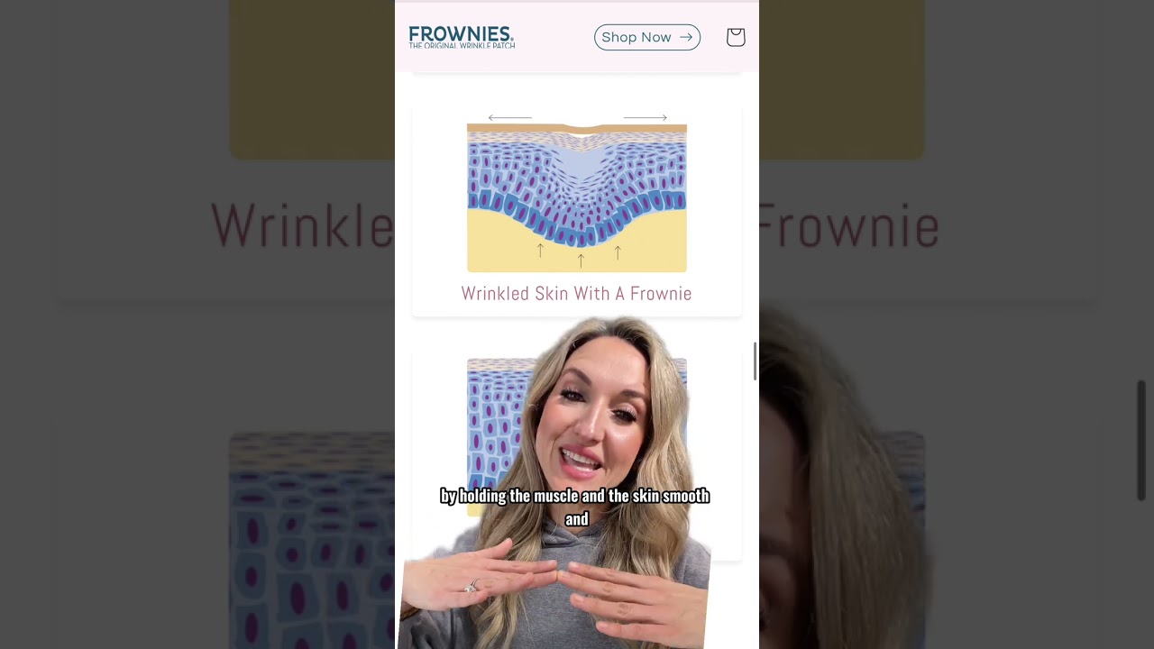 The science behind Frownies facial patches