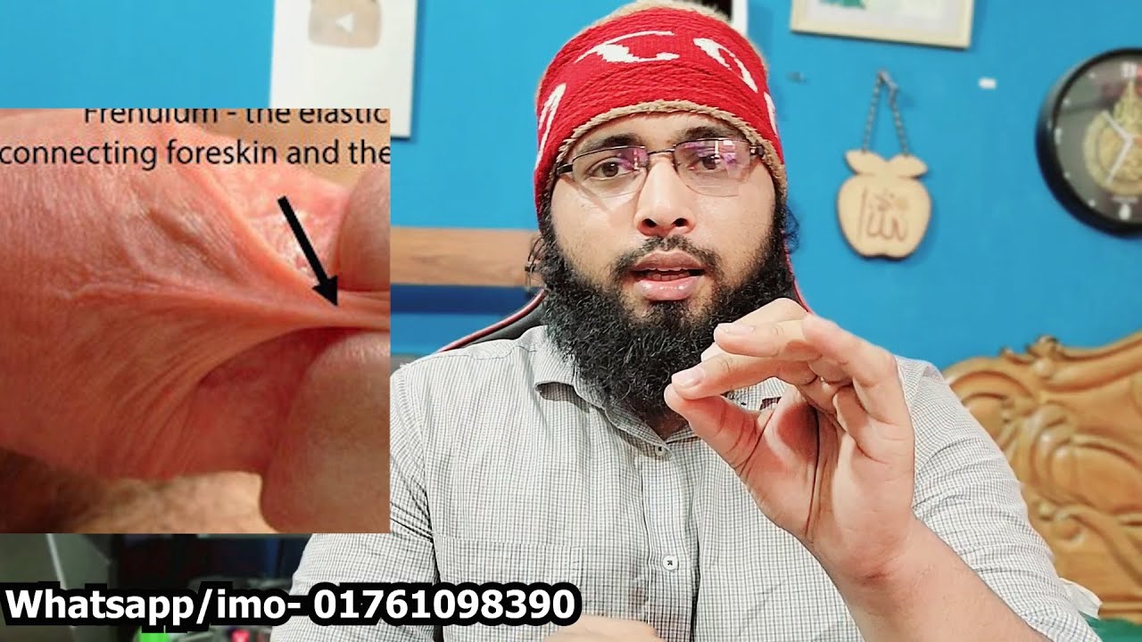 Frenuloplasty | ফ্রেনুলোপ্লাস্টি কি এবং কেন করা হয় | Dr Muhammad Ibrahim