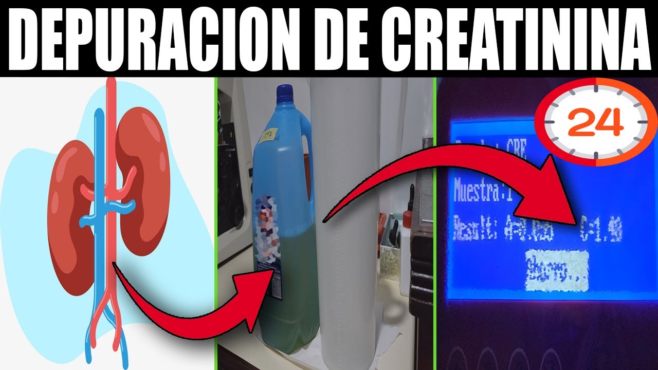 🫘¿Como hacer el examen de DEPURACION DE CREATININA en ORINA de 24 horas?Tutorias LaboratorioClinico🔬