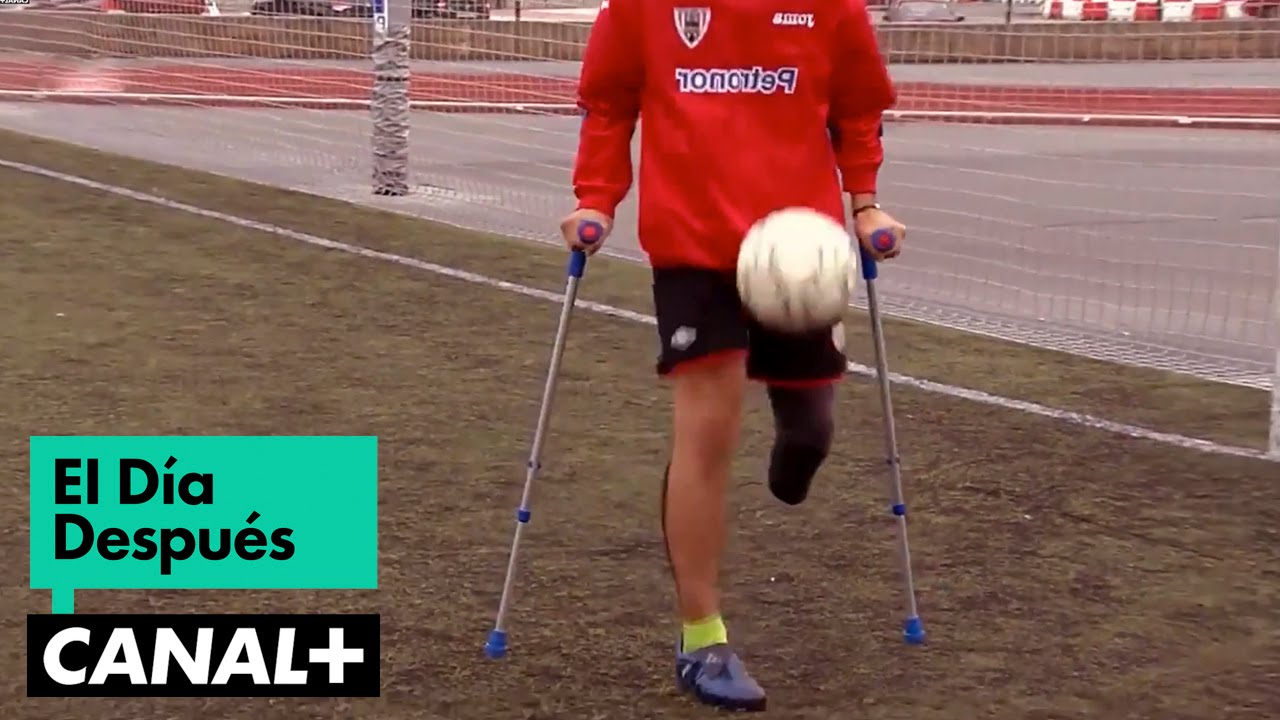 El Día Después (15/12/2014): España - Francia con Muletas