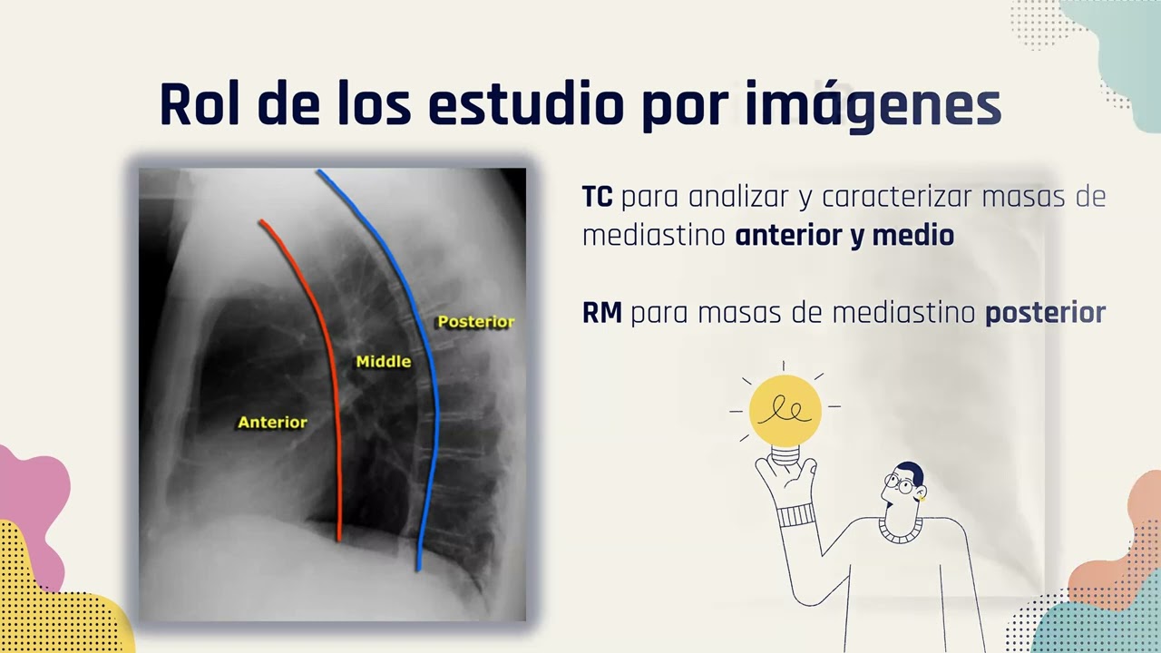 6   Masas Mediastinales