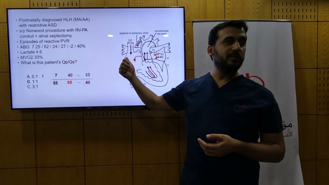 Early Complications after Single Ventricle Operations - Mohamed Elgayar
