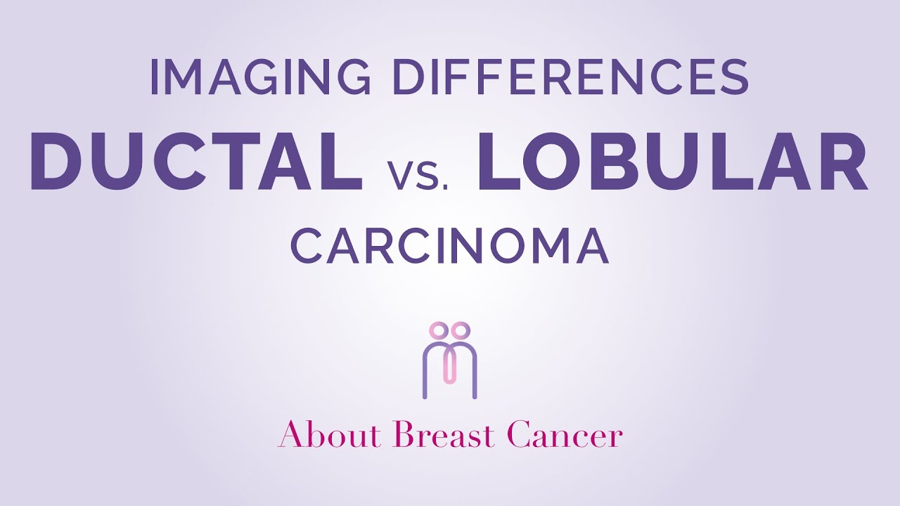 Imaging Differences between Ductal and Lobular Carcinoma