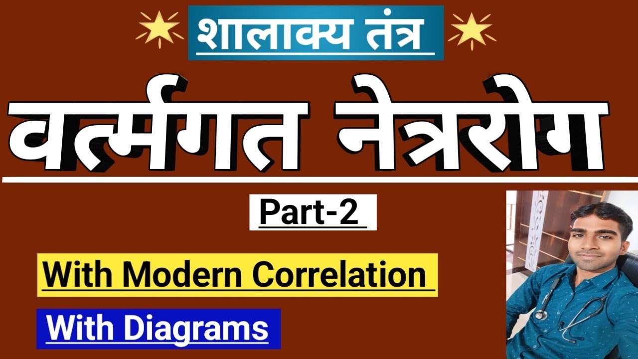 वर्तमगत रोग-2 | Vartmagata Roga | शालाक्य तंत्र | Shalakya Tantra | Vartmagata Roga Trick |
