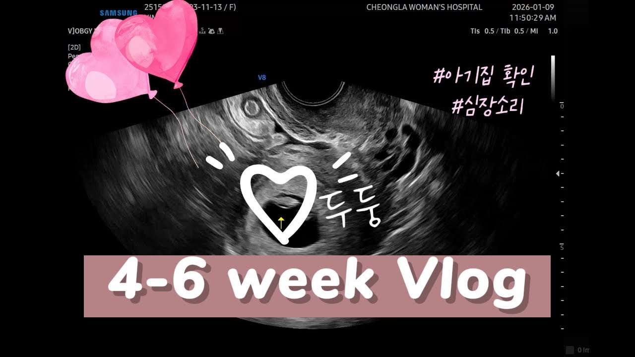 [임신 4-6주] 아기집 확인 그리고 첫 심장소리💓