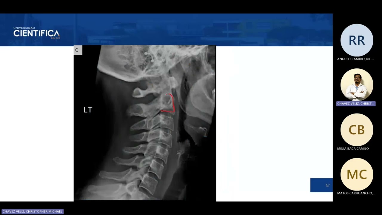 08) TUTORÍA DE ANATOMÍA DE MORFO 2 20260