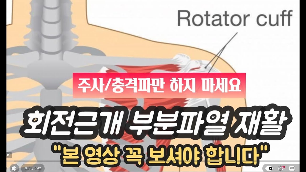 [회전근개부분파열] 집에서 할 수 있는 재활 방법 영상!!! #어깨주사 #회전근개파열