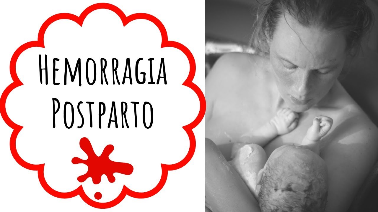 HEMORRAGIA POSTPARTO ⚠️ &middot; Causas y Prevenci&oacute;n.
