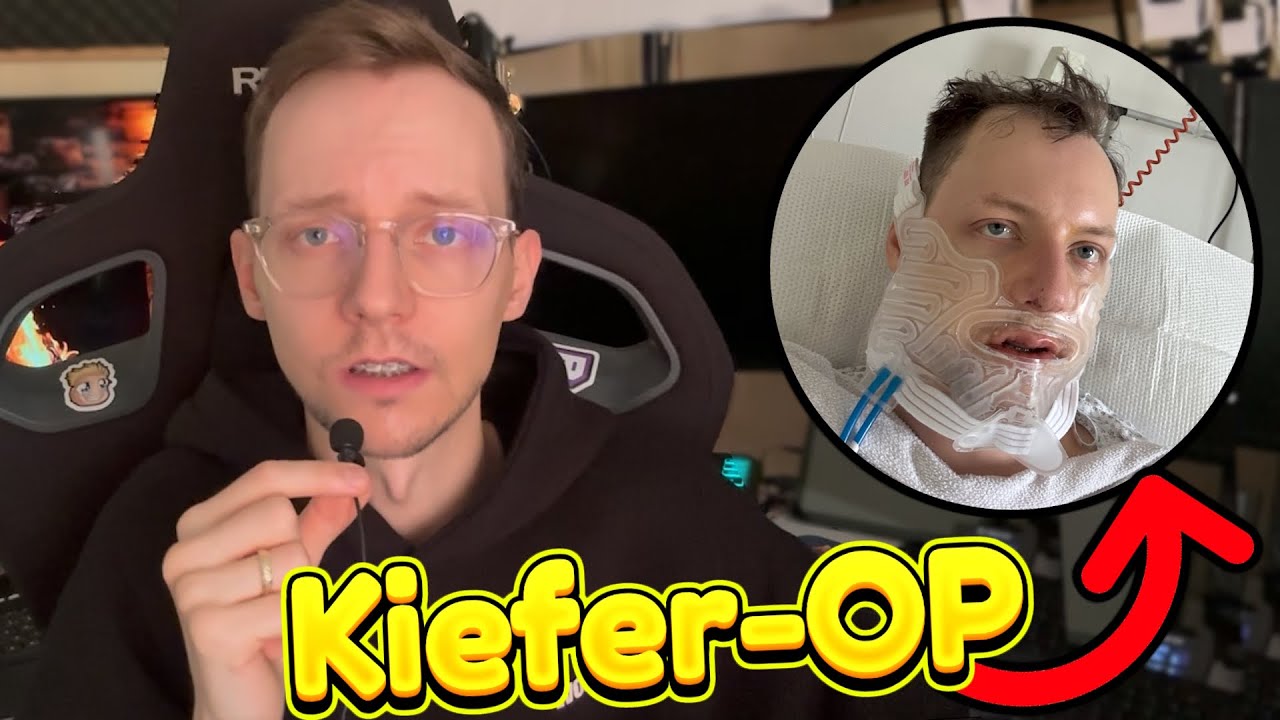 Kiefer-OP - Verlauf & Erfahrungen | 6 Wochen nach OP | Bimax - Disgnathie-OP