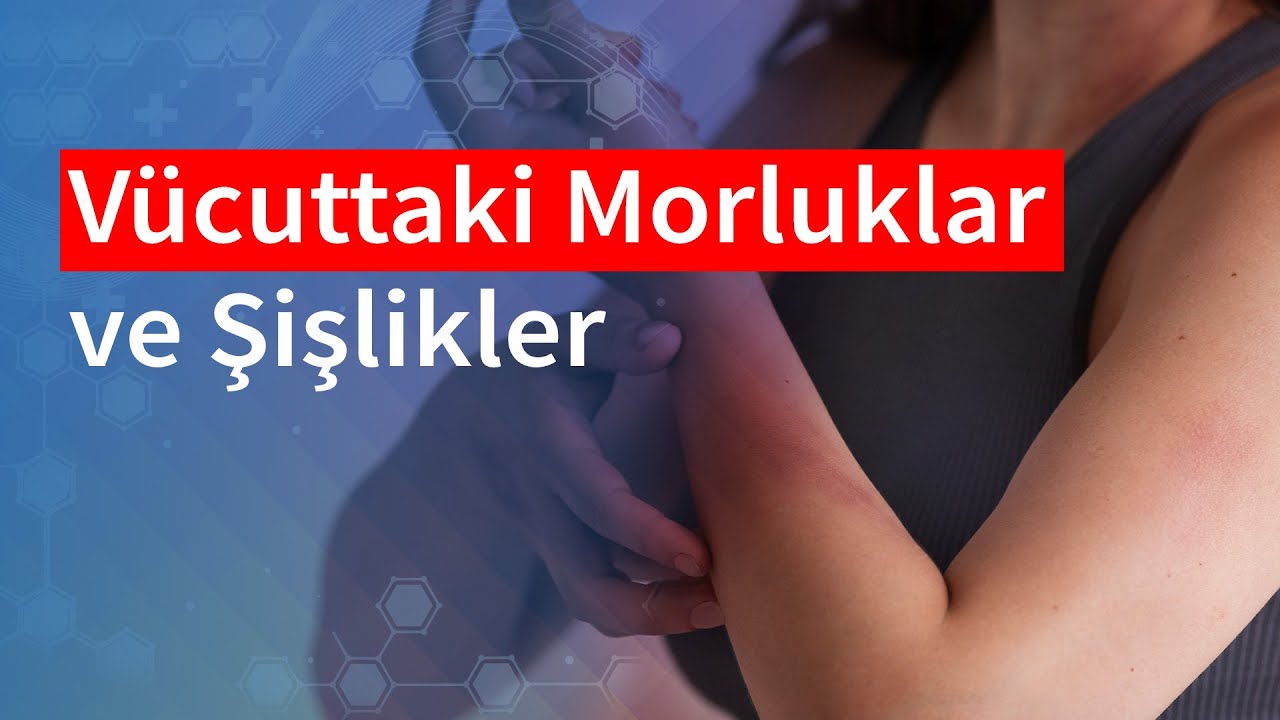 V&uuml;cuttaki Morluklar ve Şişlikler | Medical Park