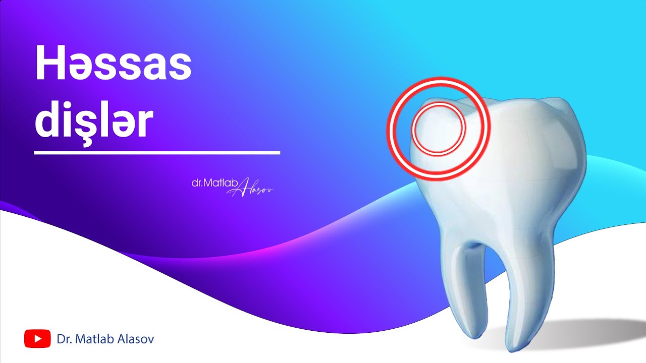 Həssas dişləriniz varsa... / Bu problemə son / Dr. Mətləb Ələsov / #sensitiveteeth #baku #stomatoloq