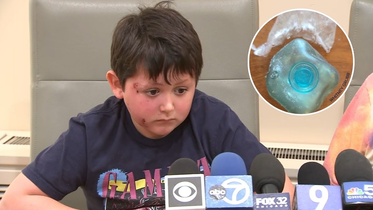 Burn victim urges kids to not follow 'Needoh Cube microwave trend' on TikTok