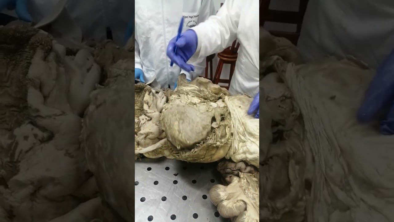 riñon lobulados  reticulo  , abomaso  , libro o omaso derecho