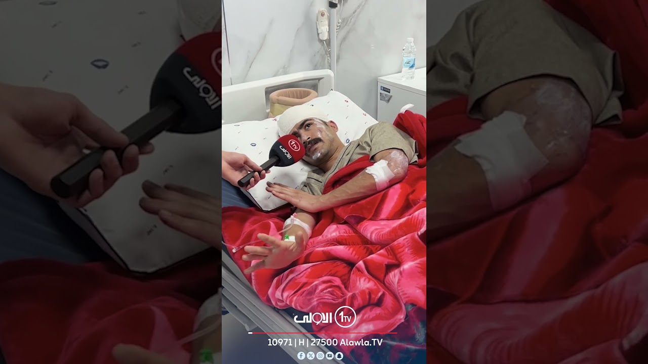 على سرير العلاج.. مصابو &ldquo;قاعدة الحبانية&rdquo; يروون لـ&rdquo;الأولى&rdquo; تفاصيل الغـ ـارة الأمريكية في الأنبار